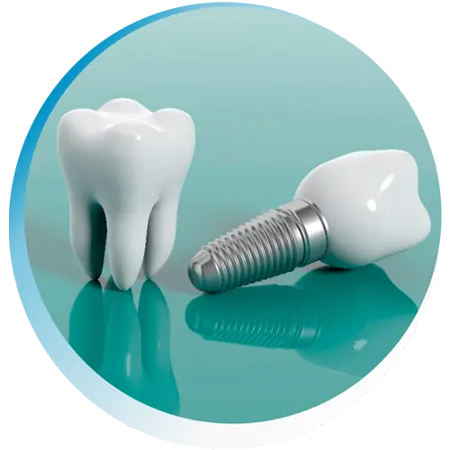 Jamil Dentista. Especialista em Implantes e Próteses Dentárias Jamil Dentista. Especialista em Implantes e Próteses Dentárias