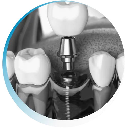 Jamil Dentista. Especialista em Implantes e Próteses Dentárias Jamil Dentista. Especialista em Implantes e Próteses Dentárias